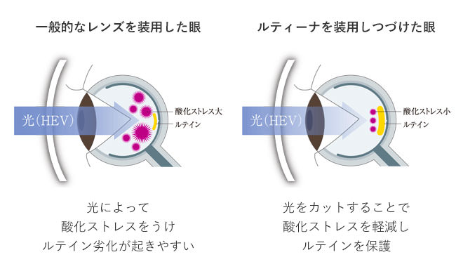 ルテイン劣化について